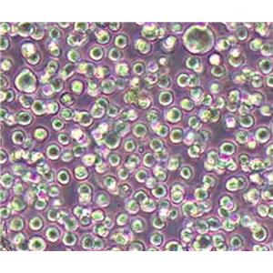 人弥漫大B淋巴瘤细胞HBL-1