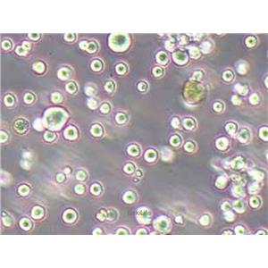 人弥漫大B淋巴瘤细胞HBL-1