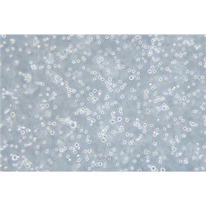 人弥漫性大B细胞淋巴瘤细胞DB(STR鉴定) | EnkiLife恩玑生命