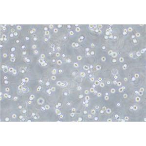 人弥漫性大B细胞淋巴瘤细胞DB