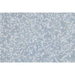 人弥漫性大B细胞淋巴瘤细胞DB