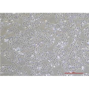 人膜间皮细胞MET-5A
