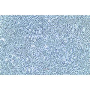 人脑胶质瘤细胞HS683