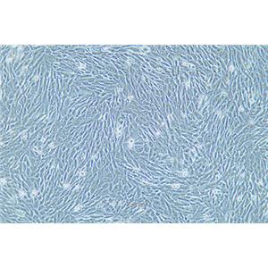 人脑胶质瘤细胞HS683