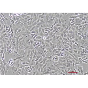 人脑胶质瘤细胞T98G