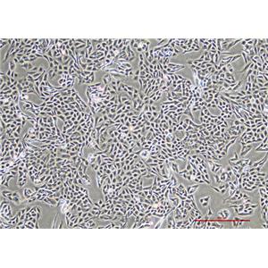 人脑胶质瘤细胞T98G