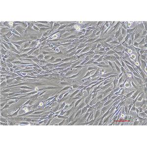 人脑星形胶质母细胞瘤U-118 MG