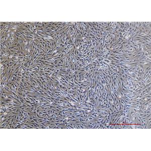 人脑星形胶质母细胞瘤U-118 MG