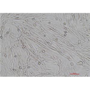 人胚肺成纤维细胞HFL-1