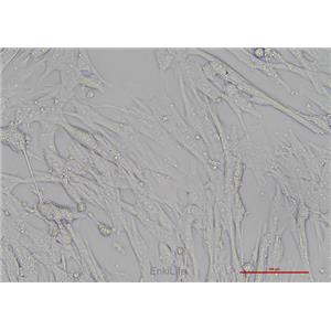 人胚肺成纤维细胞HFL-1