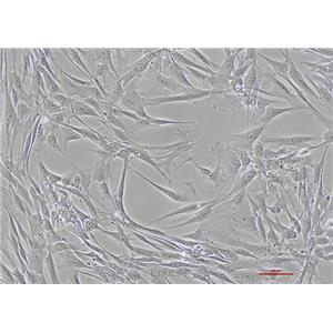 人胚皮肤成纤维细胞CCC-ESF-1