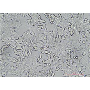 人前列腺癌细胞22RV1