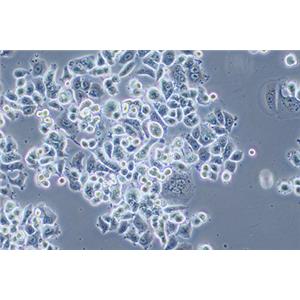 人乳腺癌细胞AU565