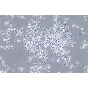 人乳腺癌细胞AU565