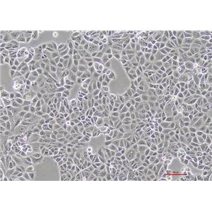 人乳腺癌细胞MCF-7