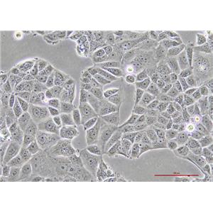 人乳腺癌细胞MCF-7