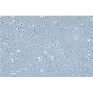 人乳腺癌细胞MDA-MB-157