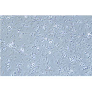 人乳腺癌细胞MDA-MB-157