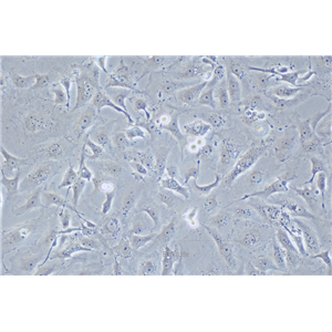 人乳腺癌细胞MDA-MB-157