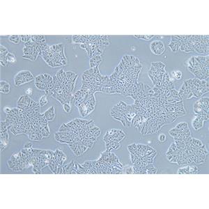 人乳腺癌细胞MDA-MB-361