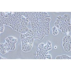 人乳腺癌细胞MDA-MB-361