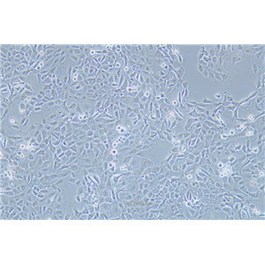 人乳腺癌细胞SUM149PT(STR鉴定) | EnkiLife恩玑生命