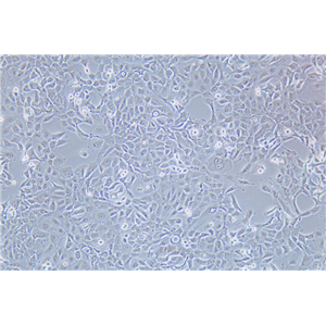 人乳腺癌细胞SUM149PT