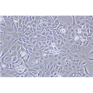 人乳腺癌细胞SUM149PT