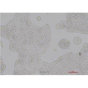 人乳腺导管瘤细胞UACC-812