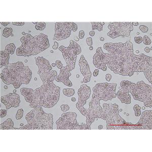 人乳腺导管瘤细胞UACC-812