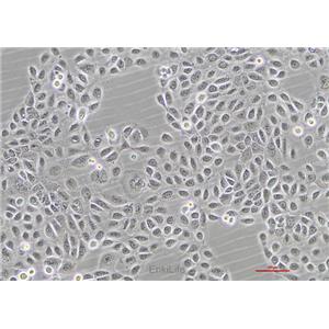人舌鳞癌细胞SCC-25(STR鉴定) | EnkiLife恩玑生命