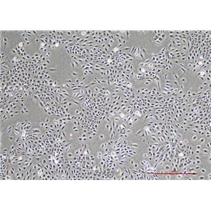 人舌鳞癌细胞Scc-9