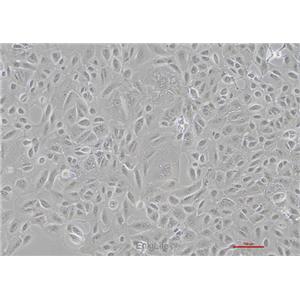 人肾癌细胞OS-RC-2