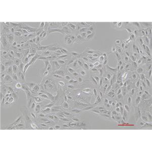 人肾癌细胞OS-RC-2