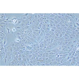 人食管癌细胞Eca-109
