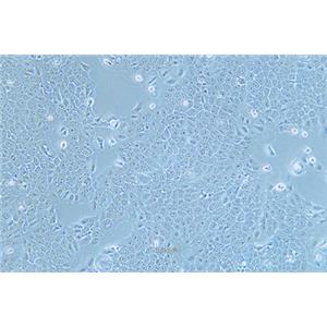 人食管癌细胞Eca-109