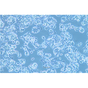 人食管癌细胞OE19