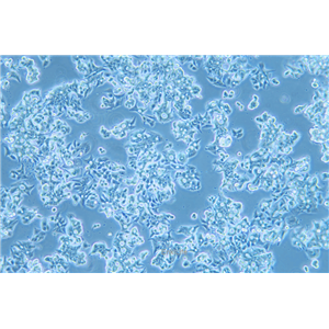 人食管癌细胞OE19