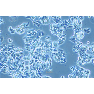 人食管癌细胞OE19