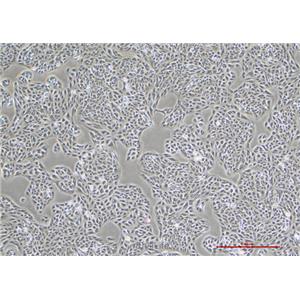 人视网膜色素上皮细胞ARPE-19