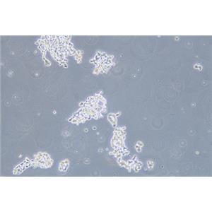 人视网膜神经胶质瘤细胞WERI-RB-1