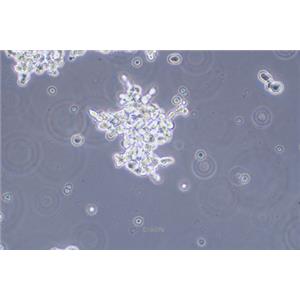 人视网膜神经胶质瘤细胞WERI-RB-1