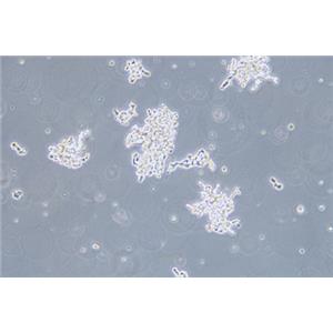 人视网膜神经胶质瘤细胞WERI-RB-1