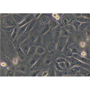 人胃癌细胞SNU-216(STR鉴定) | EnkiLife恩玑生命