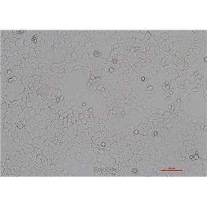 人咽鳞癌细胞FaDu