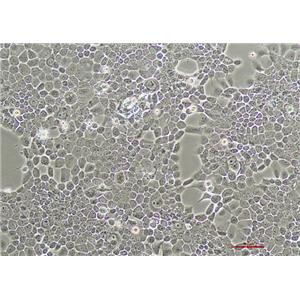 人咽鳞癌细胞FaDu