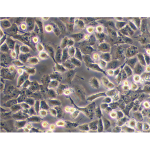 人胰腺癌细胞 PATU8988S（STR鉴定） | EnkiLife恩玑生命