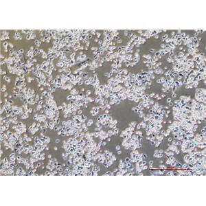 人胰腺癌细胞Capan-1