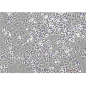人胰腺癌细胞荧光素酶稳转株PANC-1-LUC