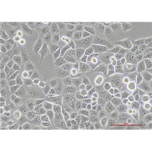 人胰腺癌细胞荧光素酶稳转株PANC-1-LUC